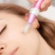 microneedling